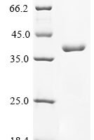 Human Butyrophilin-like protein 2 (BTNL2), partial Recombinant Protein, N-His - BioCrest Sci