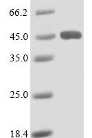 Human Lysosomal acid lipase/cholesteryl ester hydrolase (LIPA) Recombinant Protein, N-His - BioCrest Sci