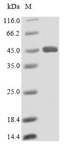 Human Lysosomal acid lipase/cholesteryl ester hydrolase (LIPA) Recombinant Protein, N-His, Homo sapiens (Human), Yeast, N-terminal 6xHis-tagged, 45.0 kDa, purity >≥ 90% as determined by SDS-PAGE.