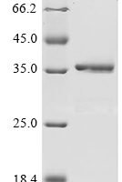 Human Cystatin-A (CSTA) Recombinant Protein - BioCrest Sci