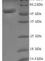 Human Malate dehydrogenase, mitochondrial (MDH2) Recombinant Protein - BioCrest Sci