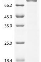 Human Nucleosome assembly protein 1-like 1 (NAP1L1) Recombinant Protein, C-10His - BioCrest Sci