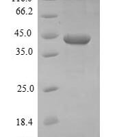 Staphylococcus aureus Iron-regulated surface determinant protein B (isdB), partial Recombinant Protein, N-His-SUMO - BioCrest Sci
