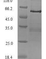 Human Tumor necrosis factor receptor type 1-associated DEATH domain protein (TRADD) Recombinant Protein, N-GST - BioCrest Sci