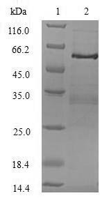 Human Tumor necrosis factor receptor type 1-associated DEATH domain protein (TRADD) Recombinant Protein, N-GST, Homo sapiens (Human), E.coli, N-terminal GST-tagged, 61.2 kDa, purity >≥ 90% as determined by SDS-PAGE.