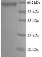 Rat Plasminogen activator inhibitor 2 type A (Serpinb2) Recombinant Protein, N-His-SUMO - BioCrest Sci