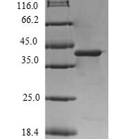 Human Diacylglycerol kinase gamma (DGKG), partial Recombinant Protein - BioCrest Sci