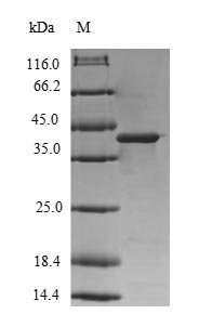 Human Diacylglycerol kinase gamma (DGKG), partial Recombinant Protein, Homo sapiens (Human), E.coli, N-terminal 6xHis-SUMO-tagged, 44.9 kDa, purity >≥ 90% as determined by SDS-PAGE.