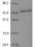 Human BPI fold-containing family A member 2 (BPIFA2) Recombinant Protein, N-His-SUMOstar - BioCrest Sci