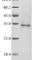 Escherichia coli Outer membrane protein assembly factor BamA (BamA), partial Recombinant Protein - BioCrest Sci