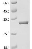 Human Sigma non-opioid intracellular receptor 1 (SIGMAR1), partial Recombinant Protein, C-His - BioCrest Sci