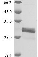 Human Plasminogen activator inhibitor 1 (SERPINE1), partial Recombinant Protein, N-GST - BioCrest Sci