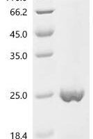 Human Remodeling and spacing factor 1 (RSF1), partial Recombinant Protein - BioCrest Sci