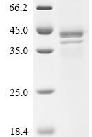 Human Guanine nucleotide-binding protein G(i) subunit alpha-1 (GNAI1) Recombinant Protein, C-10His - BioCrest Sci