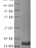 Bovine Resistin (RETN) Recombinant Protein - BioCrest Sci