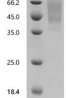 Human Transcription factor SOX-3 (SOX3) Recombinant Protein - BioCrest Sci