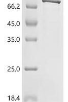 Human Signal recognition particle receptor subunit alpha (SRPRA) Recombinant Protein - BioCrest Sci