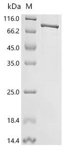 Human Signal recognition particle receptor subunit alpha (SRPRA) Recombinant Protein, Homo sapiens (Human), E.coli, C-terminal 6xHis-tagged, 76.7 kDa, purity >≥ 85% as determined by SDS-PAGE.
