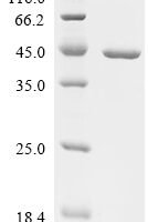 Escherichia coli Tryptophan--tRNA ligase (trpS) Recombinant Protein - BioCrest Sci