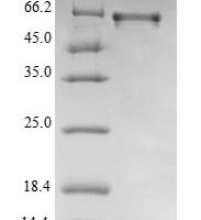 Mouse 25-hydroxyvitamin D-1 alpha hydroxylase, mitochondrial (Cyp27b1) Recombinant Protein - BioCrest Sci