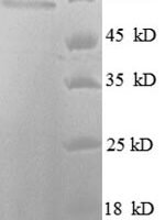 Human Histone deacetylase 3 (HDAC3) Recombinant Protein, N-His-SUMO - BioCrest Sci