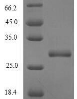 Prunus persica Profilin Recombinant Protein - BioCrest Sci