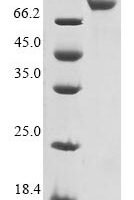 Human Neuron navigator 1 (NAV1), partial Recombinant Protein - BioCrest Sci