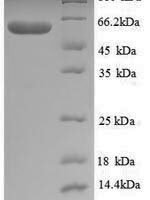 Thermus aquaticus DNA polymerase I, thermostable (polA), partial Recombinant Protein, N-His - BioCrest Sci