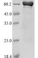 Human Coiled-coil domain-containing protein 112 (CCDC112) Recombinant Protein - BioCrest Sci