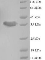 Staphylococcus aureus Acyl carrier protein (acpP) Recombinant Protein, N-GST, aa 1–77, Yeast - BioCrest Sci