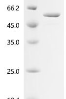 Escherichia coli Aspartate carbamoyltransferase catalytic subunit (pyrB) Recombinant Protein - BioCrest Sci