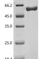 Human N-acetylgalactosamine-6-sulfatase (GALNS) Recombinant Protein, N-His, aa 27–522, Mammalian cell - BioCrest Sci