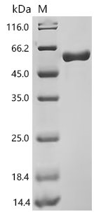 Human N-acetylgalactosamine-6-sulfatase (GALNS) Recombinant Protein, N-His, aa 27–522, Mammalian cell, Homo sapiens (Human), Mammalian cell, N-terminal 6xHis-tagged, 56.1 kDa, purity >≥ 95% as determined by SDS-PAGE.