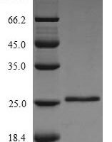 Bovine Glycolipid transfer protein (GLTP) Recombinant Protein, N-His - BioCrest Sci