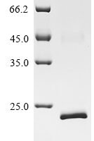 Human Relaxin receptor 2 (RXFP2), partial Recombinant Protein - BioCrest Sci