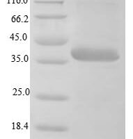 BK polyomavirus Minor capsid protein VP2 Recombinant Protein, N-10His - BioCrest Sci