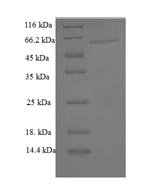 Mouse Galectin-6 (Lgals6) Recombinant Protein - BioCrest Sci