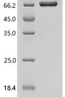 Human Probable palmitoyltransferase ZDHHC6 (ZDHHC6), partial, Biotinylated Recombinant Protein - BioCrest Sci