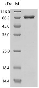 Human Probable palmitoyltransferase ZDHHC6 (ZDHHC6), partial, Biotinylated Recombinant Protein, Homo sapiens (Human), E.coli, N-terminal MBP-tagged and C-terminal 6xHis-Avi-tagged, 69.3 kDa, purity >≥ 85% as determined by SDS-PAGE.