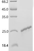 Mouse Platelet-derived growth factor subunit A (Pdgfa) Recombinant Protein, C-His - BioCrest Sci