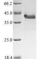 Mouse Complement C4-B (C4b), partial Recombinant Protein - BioCrest Sci
