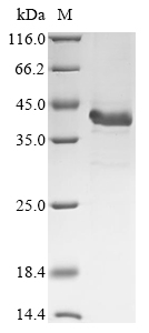 Mouse Complement C4-B (C4b), partial Recombinant Protein, Mus musculus (Mouse), E.coli, N-terminal 10xHis-tagged and C-terminal Myc-tagged, 40.5 kDa, purity >≥ 85% as determined by SDS-PAGE.