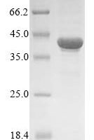 Human Thioredoxin domain-containing protein 5 (TXNDC5) Recombinant Protein, Tag-Free - BioCrest Sci