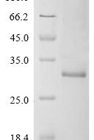 Human Transcriptional enhancer factor TEF-1 (TEAD1), partial Recombinant Protein, N-10His - BioCrest Sci