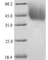 Mouse Dihydrolipoyllysine-residue acetyltransferase component of pyruvate dehydrogenase complex, mitochondrial (Dlat) Recombinant Protein - BioCrest Sci