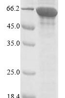 Saccharomyces cerevisiae Acetyl-CoA carboxylase (ACC1), partial Recombinant Protein, N-10His, aa 217–775 - BioCrest Sci