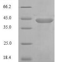 Human Probetacellulin [Cleaved into: Betacellulin protein (BTC) Recombinant Protein - BioCrest Sci