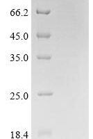 Naja atra Cytotoxin 3 Recombinant Protein - BioCrest Sci