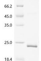 Arabidopsis thaliana Ferredoxin-thioredoxin reductase catalytic chain, chloroplastic (FTRC) Recombinant Protein - BioCrest Sci