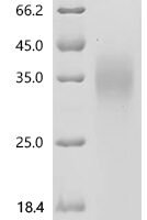 Human Fos-related antigen 1 (FOSL1) Recombinant Protein, C-His, aa 1–271, Yeast - BioCrest Sci
